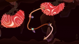 Esophaguys